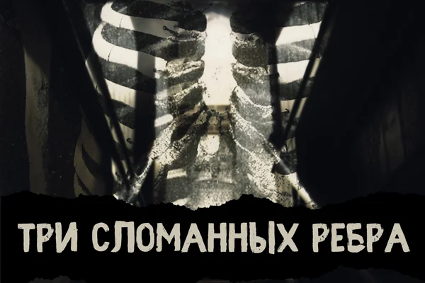 Три сломанных ребра